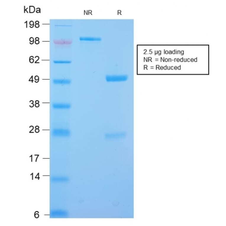 SDS-PAGE - Anti-Desmin Antibody [DES/2960R] (A248334) - Antibodies.com