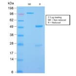 SDS-PAGE - Anti-Desmin Antibody [DES/2960R] (A248334) - Antibodies.com