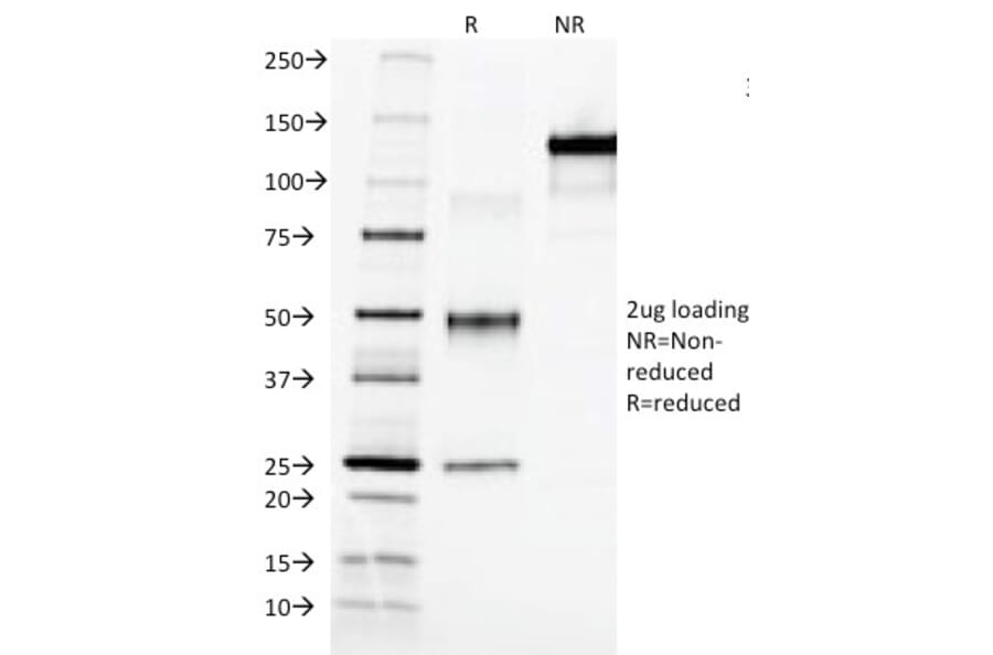 SDS-PAGE - Anti-alpha Fetoprotein Antibody [C3] (A248335) - Antibodies.com
