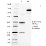 SDS-PAGE - Anti-alpha Fetoprotein Antibody [C3] (A248335) - Antibodies.com