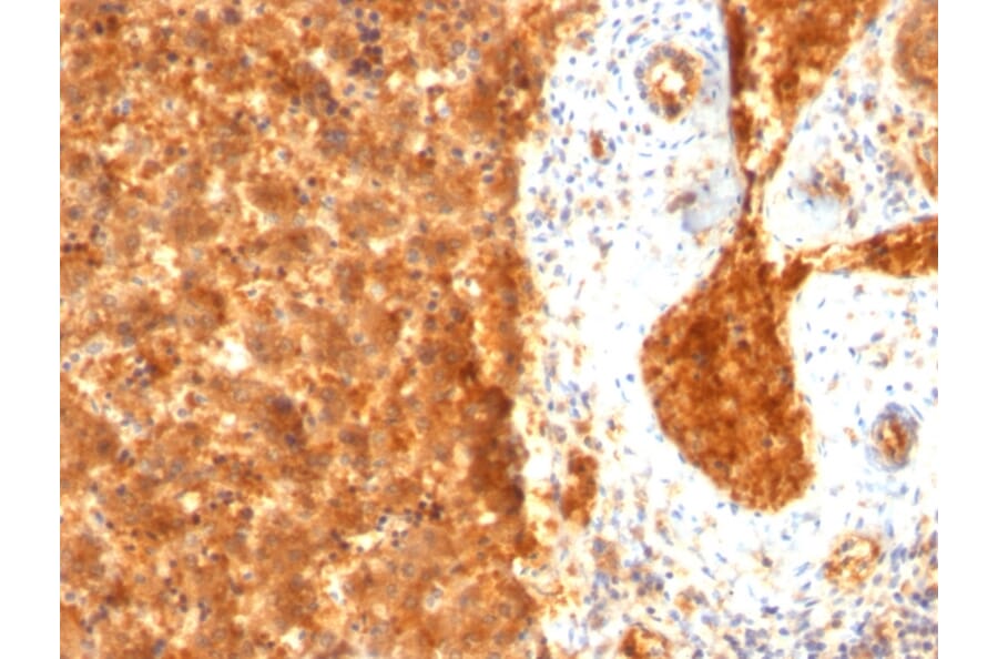 Immunohistochemistry - Anti-alpha Fetoprotein Antibody [SPM334] (A248335) - Antibodies.com