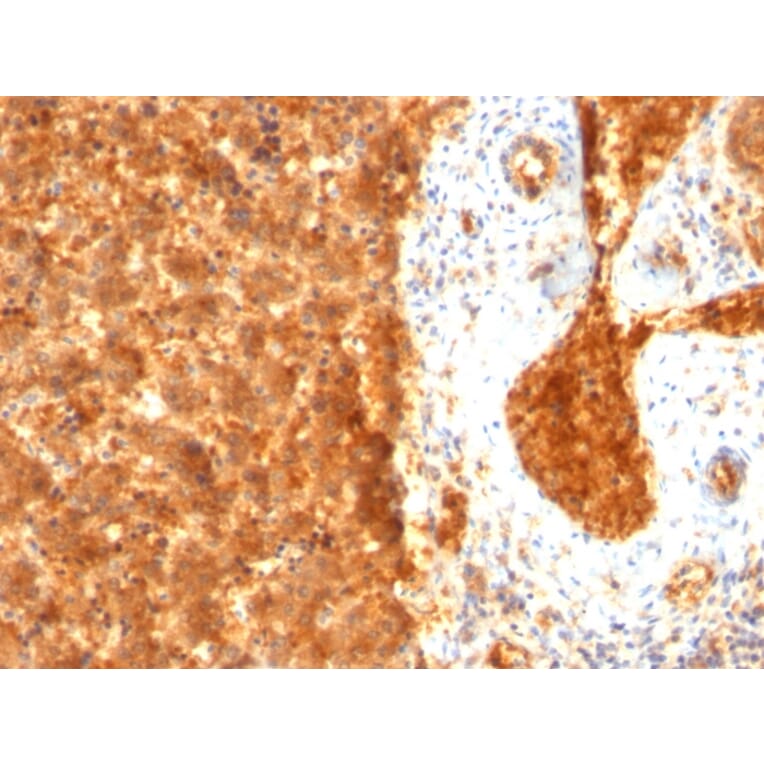 Immunohistochemistry - Anti-alpha Fetoprotein Antibody [SPM334] (A248335) - Antibodies.com