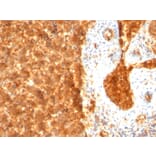 Immunohistochemistry - Anti-alpha Fetoprotein Antibody [SPM334] (A248335) - Antibodies.com