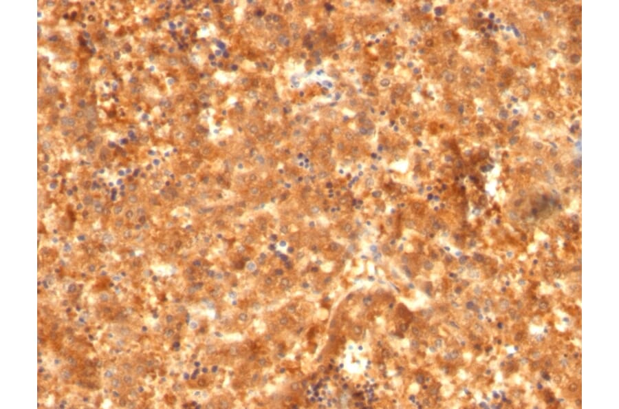 Immunohistochemistry - Anti-alpha Fetoprotein Antibody [C2 + C3 + MBS-12] (A252427) - Antibodies.com