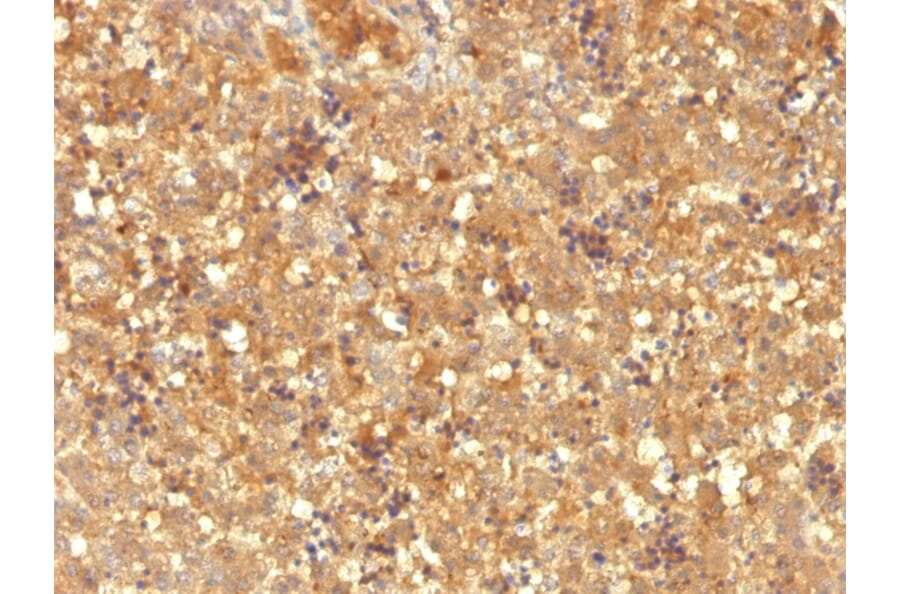 Immunohistochemistry - Anti-alpha Fetoprotein Antibody [MBS-12] (A248337) - Antibodies.com