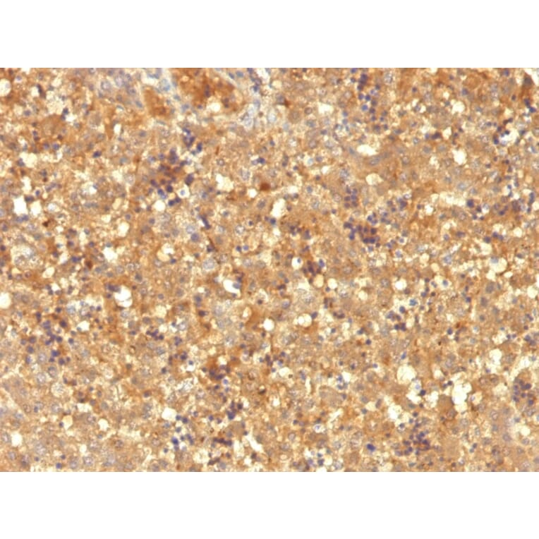 Immunohistochemistry - Anti-alpha Fetoprotein Antibody [MBS-12] (A248337) - Antibodies.com