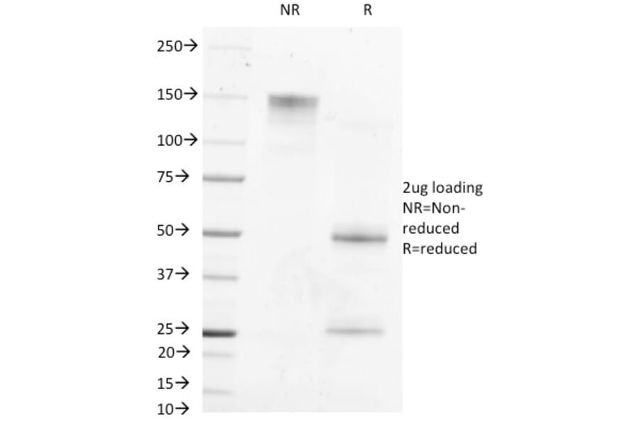 SDS-PAGE - Anti-alpha Fetoprotein Antibody [MBS-12] (A248338) - Antibodies.com