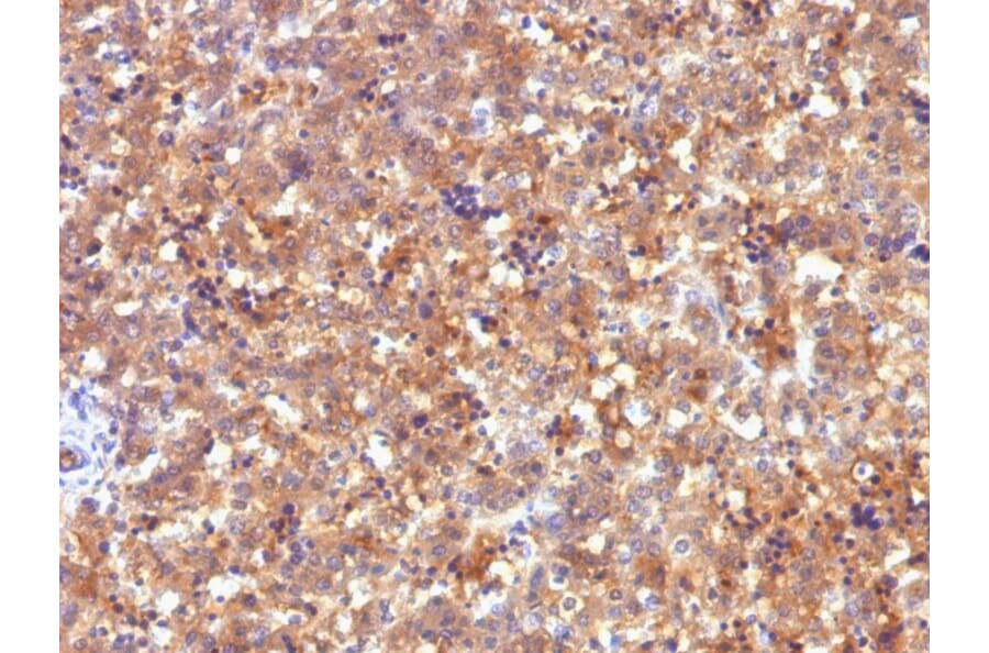 Immunohistochemistry - Anti-alpha Fetoprotein Antibody [C2] (A248338) - Antibodies.com