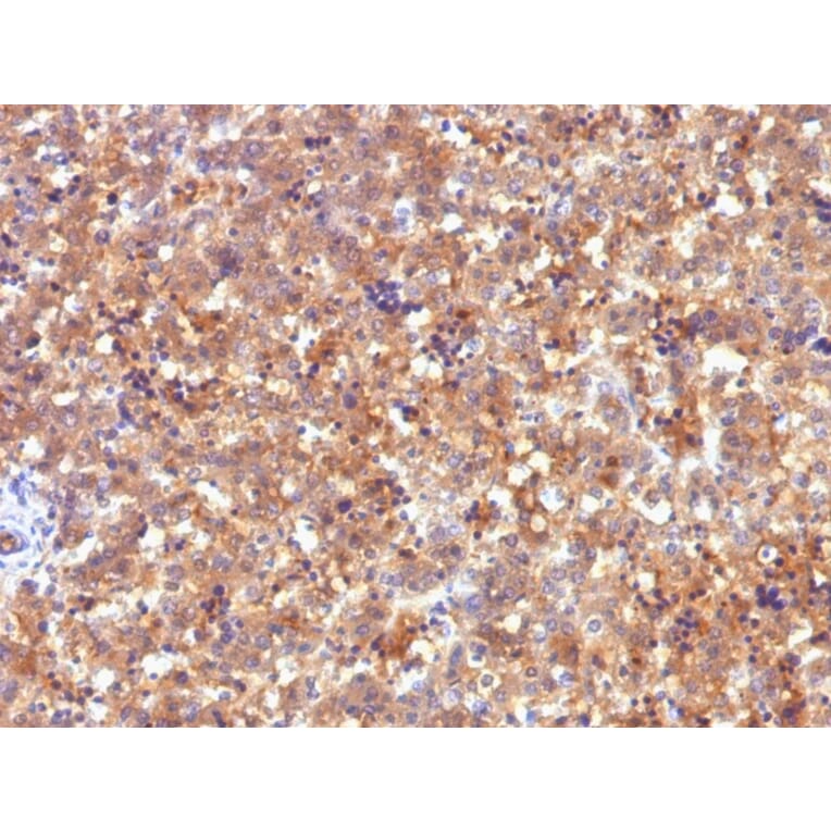 Immunohistochemistry - Anti-alpha Fetoprotein Antibody [C2] (A248338) - Antibodies.com