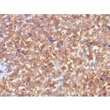 Immunohistochemistry - Anti-alpha Fetoprotein Antibody [C2] (A248338) - Antibodies.com