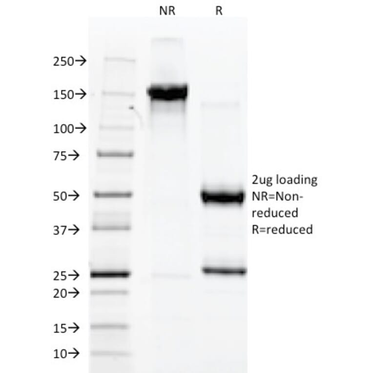 SDS-PAGE - Anti-alpha Fetoprotein Antibody [C2] (A248339) - Antibodies.com