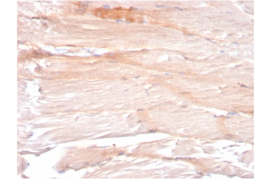 Immunohistochemistry - Anti-Dystrophin Antibody [DMD/3241] (A248340) - Antibodies.com