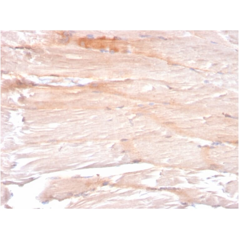 Immunohistochemistry - Anti-Dystrophin Antibody [DMD/3241] (A248340) - Antibodies.com