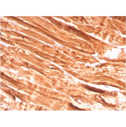 Immunohistochemistry - Anti-Dystrophin Antibody [DMD/3242] (A248341) - Antibodies.com