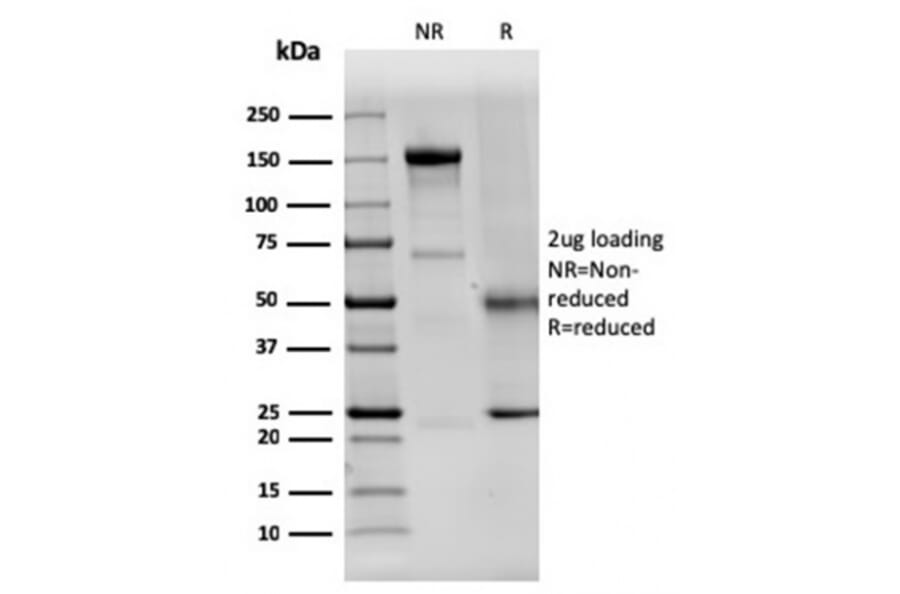 SDS-PAGE - Anti-Dystrophin Antibody [DMD/3242] (A248341) - Antibodies.com