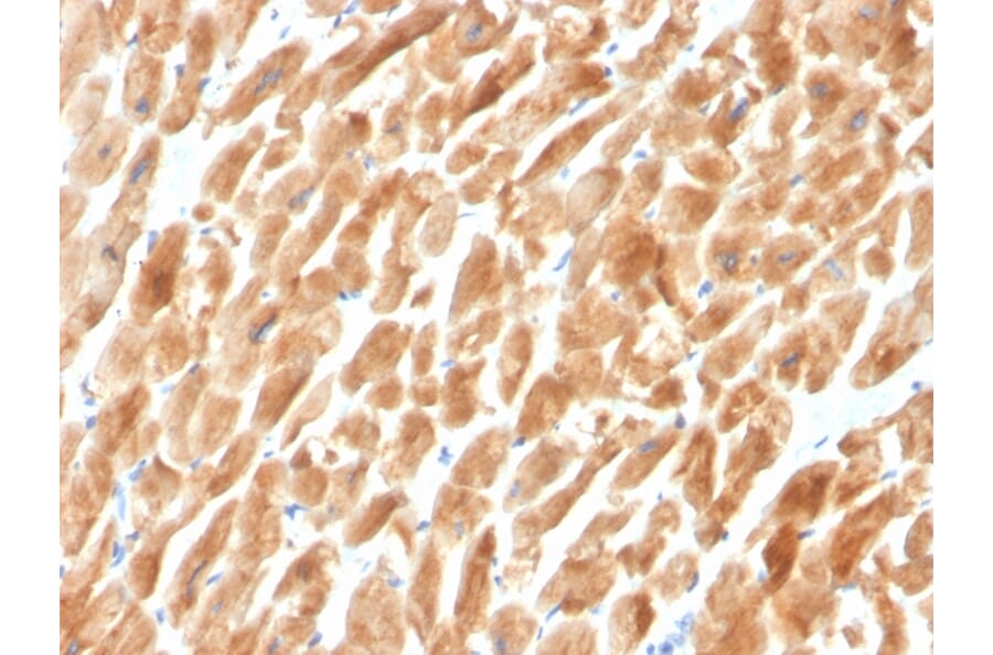 Immunohistochemistry - Anti-Dystrophin Antibody [DMD/3242] (A248341) - Antibodies.com