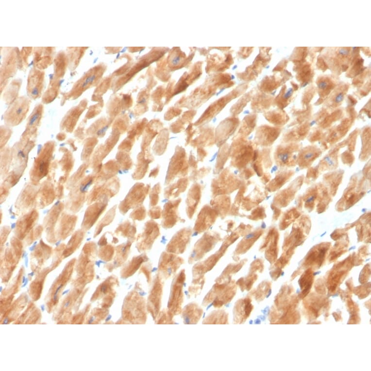 Immunohistochemistry - Anti-Dystrophin Antibody [DMD/3242] (A248341) - Antibodies.com