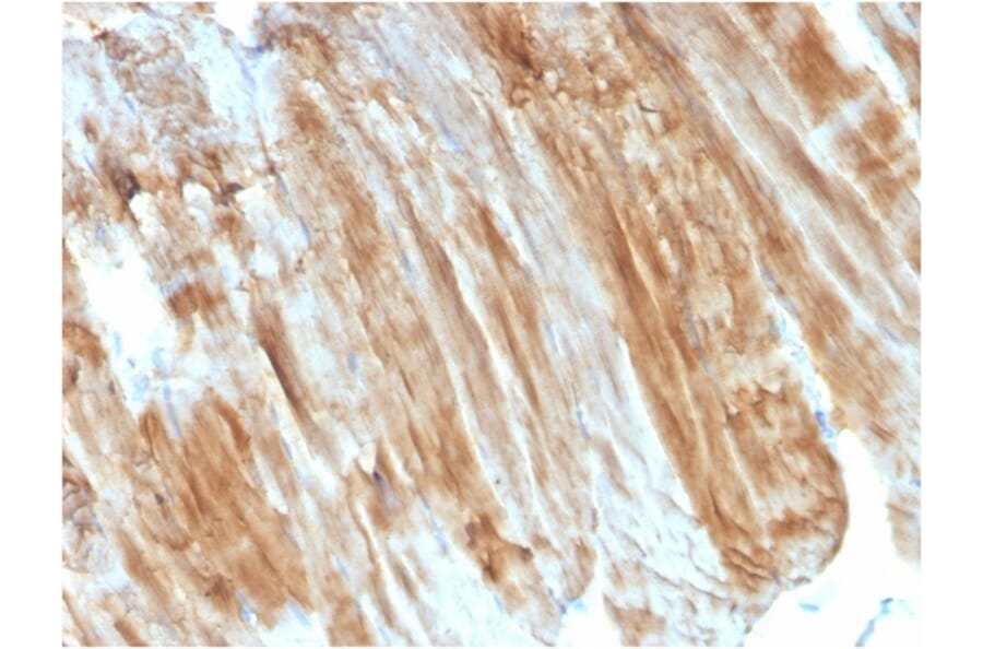 Immunohistochemistry - Anti-Dystrophin Antibody [DMD/3243] (A248342) - Antibodies.com