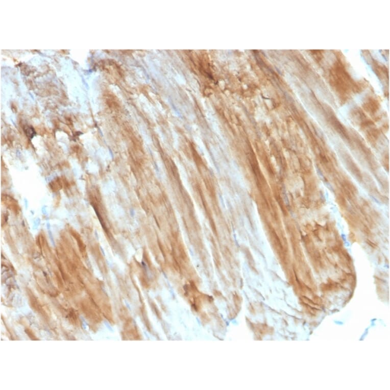 Immunohistochemistry - Anti-Dystrophin Antibody [DMD/3243] (A248342) - Antibodies.com