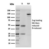 SDS-PAGE - Anti-Dystrophin Antibody [DMD/3243] (A248342) - Antibodies.com