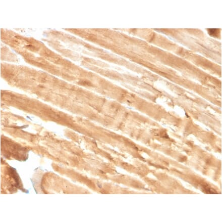 Immunohistochemistry - Anti-Dystrophin Antibody [DMD/3244] (A248343) - Antibodies.com
