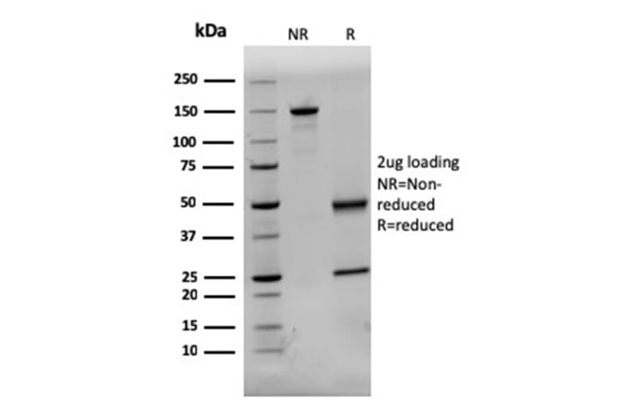 SDS-PAGE - Anti-Dystrophin Antibody [DMD/3244] (A248343) - Antibodies.com