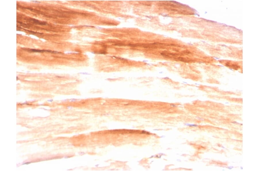 Immunohistochemistry - Anti-Dystrophin Antibody [DMD/3245] (A248344) - Antibodies.com