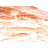Immunohistochemistry - Anti-Dystrophin Antibody [DMD/3245] (A248344) - Antibodies.com