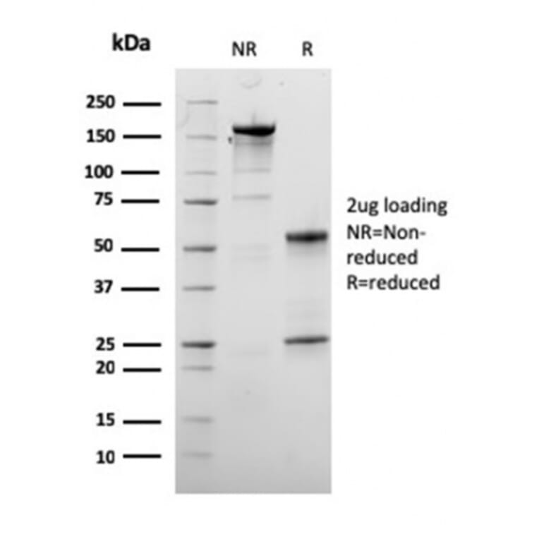SDS-PAGE - Anti-Dystrophin Antibody [DMD/3245] (A248344) - Antibodies.com
