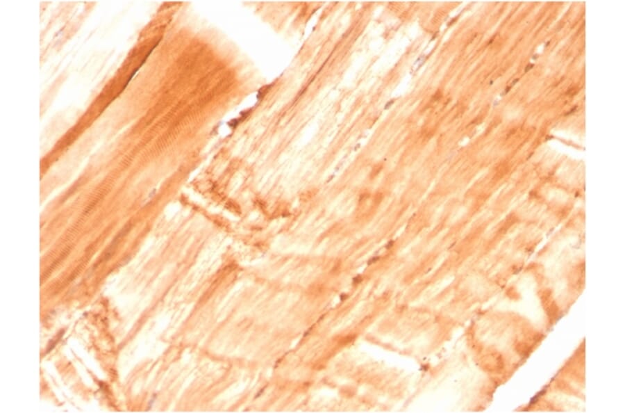 Immunohistochemistry - Anti-Dystrophin Antibody [DMD/3677] (A248345) - Antibodies.com