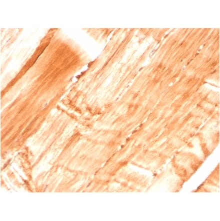 Immunohistochemistry - Anti-Dystrophin Antibody [DMD/3677] (A248345) - Antibodies.com