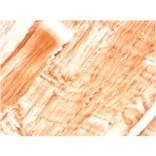 Immunohistochemistry - Anti-Dystrophin Antibody [DMD/3677] (A248345) - Antibodies.com