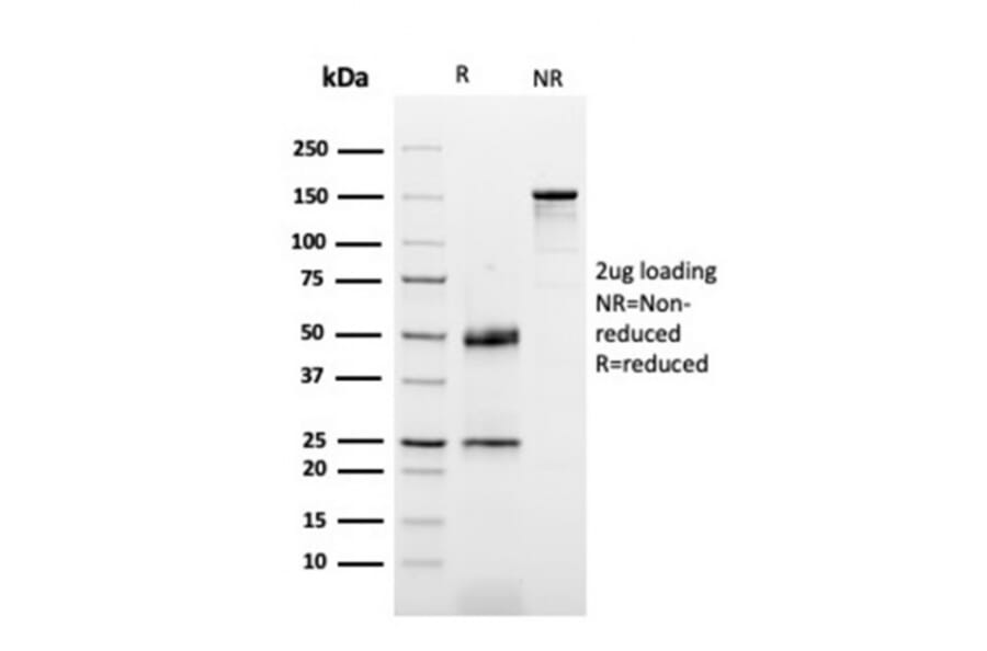 SDS-PAGE - Anti-Dystrophin Antibody [DMD/3677] (A248345) - Antibodies.com