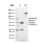 SDS-PAGE - Anti-Dystrophin Antibody [DMD/3677] (A248345) - Antibodies.com