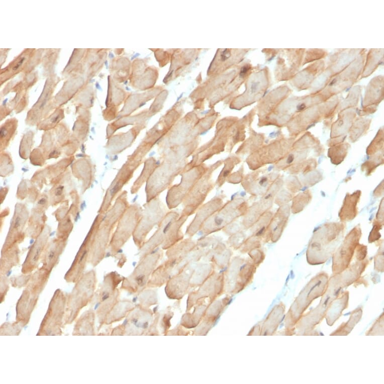 Immunohistochemistry - Anti-Dystrophin Antibody [DMD/3677] (A248344) - Antibodies.com