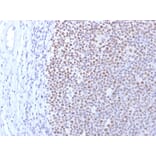 Immunohistochemistry - Anti-DNMT1 Antibody [DNMT1/2061] (A248346) - Antibodies.com