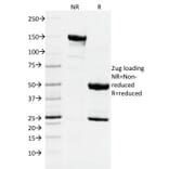 SDS-PAGE - Anti-DNMT1 Antibody [DNMT1/2061] (A248346) - Antibodies.com