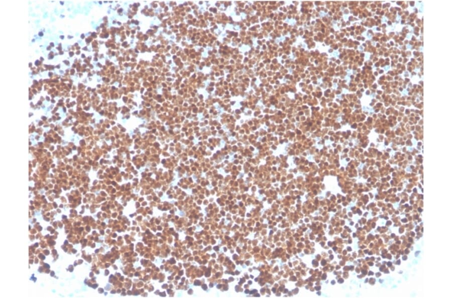 Immunohistochemistry - Anti-TdT Antibody [TDT/1393] (A248348) - Antibodies.com