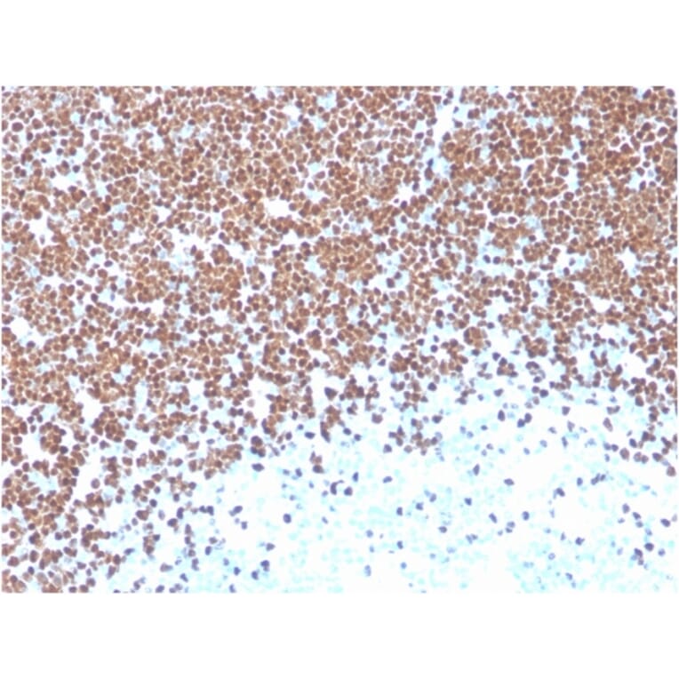 Immunohistochemistry - Anti-TdT Antibody [TDT/1393] (A248348) - Antibodies.com