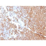 Immunohistochemistry - Anti-TdT Antibody [DNTT/1453] (A248349) - Antibodies.com