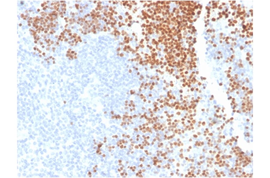 Immunohistochemistry - Anti-TdT Antibody [DNTT/1453] (A248349) - Antibodies.com