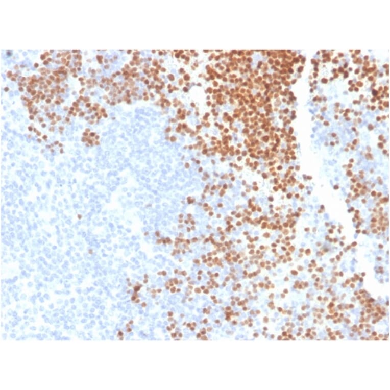 Immunohistochemistry - Anti-TdT Antibody [DNTT/1453] (A248349) - Antibodies.com