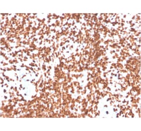 Immunohistochemistry - Anti-TdT Antibody [DNTT/4506R] (A248350) - Antibodies.com