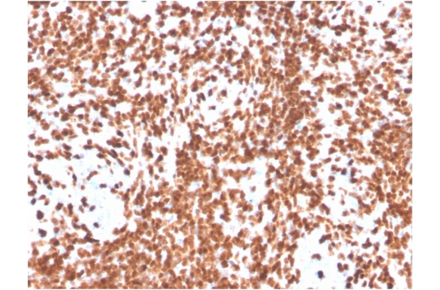 Immunohistochemistry - Anti-TdT Antibody [DNTT/4506R] (A248350) - Antibodies.com