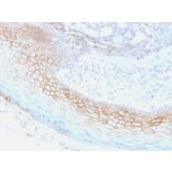 Immunohistochemistry - Anti-Desmocollin 2 Antibody [7G6] (A248354) - Antibodies.com