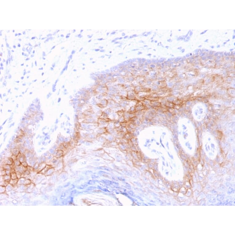 Immunohistochemistry - Anti-Desmocollin 2 Antibody [7G6] (A248350) - Antibodies.com