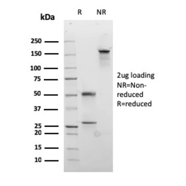 SDS-PAGE - Anti-Desmocollin 2 Antibody [rDSC2/3437] (A248354) - Antibodies.com