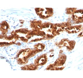 Immunohistochemistry - Anti-TAG72 Antibody [B72.3] (A248356) - Antibodies.com
