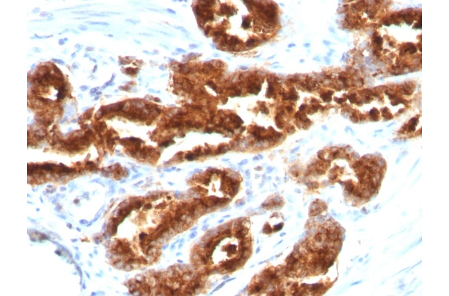 Immunohistochemistry - Anti-TAG72 Antibody [B72.3] (A248356) - Antibodies.com