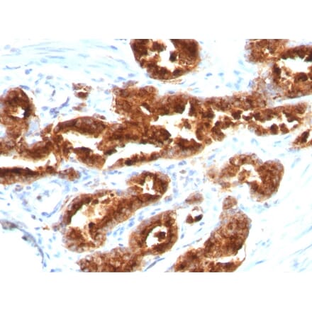 Immunohistochemistry - Anti-TAG72 Antibody [B72.3] (A248356) - Antibodies.com